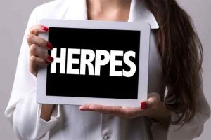 Read more about the article Genital Herpes Protection: HSV Intravaginal Microbiocide Works in Mice